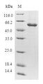 Thymidylate Kinase Protein - (Tris-Glycine gel) Discontinuous SDS-PAGE (reduced) with 5% enrichment gel and 15% separation gel.