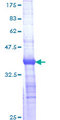 Thymidylate Kinase Protein - 12.5% SDS-PAGE Stained with Coomassie Blue.
