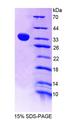 THYN1 / HSPC144 Protein - Recombinant Thymocyte Nuclear Protein 1 By SDS-PAGE