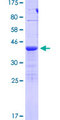 TIAF1 Protein - 12.5% SDS-PAGE of human TIAF1 stained with Coomassie Blue