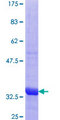 TIMM10B / FXC1 Protein - 12.5% SDS-PAGE Stained with Coomassie Blue.