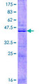 TIMM17A / TIM17 Protein - 12.5% SDS-PAGE of human TIMM17A stained with Coomassie Blue