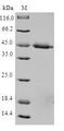 TIMM17A / TIM17 Protein - (Tris-Glycine gel) Discontinuous SDS-PAGE (reduced) with 5% enrichment gel and 15% separation gel.