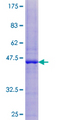 TIMM17B Protein - 12.5% SDS-PAGE of human TIMM17B stained with Coomassie Blue