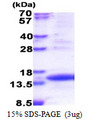 TIMM8A Protein