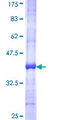 TIMM8B Protein - 12.5% SDS-PAGE Stained with Coomassie Blue.