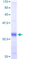 TIMM9 Protein - 12.5% SDS-PAGE of human TIMM9 stained with Coomassie Blue