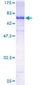 TLE6 Protein - 12.5% SDS-PAGE of human TLE6 stained with Coomassie Blue