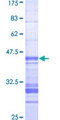 TLK1 Protein - 12.5% SDS-PAGE Stained with Coomassie Blue.