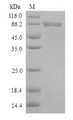TLR1 Protein - (Tris-Glycine gel) Discontinuous SDS-PAGE (reduced) with 5% enrichment gel and 15% separation gel.