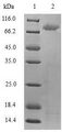 TLR2 Protein - (Tris-Glycine gel) Discontinuous SDS-PAGE (reduced) with 5% enrichment gel and 15% separation gel.