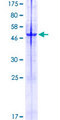 TM2D2 Protein - 12.5% SDS-PAGE of human TM2D2 stained with Coomassie Blue