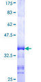 TMEM1 / TRAPPC10 Protein - 12.5% SDS-PAGE Stained with Coomassie Blue.