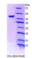 TMEM1 / TRAPPC10 Protein - Recombinant Transmembrane Protein 1 By SDS-PAGE