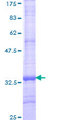 TMEM11 Protein - 12.5% SDS-PAGE Stained with Coomassie Blue.