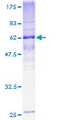 TMEM115 Protein - 12.5% SDS-PAGE of human PL6 stained with Coomassie Blue