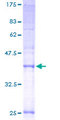 TMEM138 / HSPC196 Protein - 12.5% SDS-PAGE of human HSPC196 stained with Coomassie Blue