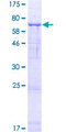 TMEM39A Protein - 12.5% SDS-PAGE of human TMEM39A stained with Coomassie Blue