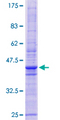 TMEM42 Protein - 12.5% SDS-PAGE of human TMEM42 stained with Coomassie Blue