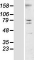 TMEM44 Protein - Western validation with an anti-DDK antibody * L: Control HEK293 lysate R: Over-expression lysate