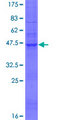 TMEM54 Protein - 12.5% SDS-PAGE of human TMEM54 stained with Coomassie Blue