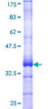 TMEM7 / RTP3 Protein - 12.5% SDS-PAGE Stained with Coomassie Blue.