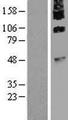 TMEM8B / NGX6 Protein - Western validation with an anti-DDK antibody * L: Control HEK293 lysate R: Over-expression lysate