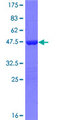 TNFAIP8L2 Protein - 12.5% SDS-PAGE of human TNFAIP8L2 stained with Coomassie Blue