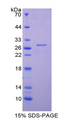 TNNI3 / Cardiac Troponin I Protein - Recombinant Troponin I Type 3, Cardiac By SDS-PAGE