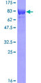 TOM1 Protein - 12.5% SDS-PAGE of human TOM1 stained with Coomassie Blue