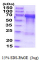 TOM1L2 Protein
