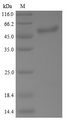 TP53 / p53 Protein - (Tris-Glycine gel) Discontinuous SDS-PAGE (reduced) with 5% enrichment gel and 15% separation gel.