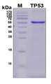 TP53 / p53 Protein - SDS-PAGE under reducing conditions and visualized by Coomassie blue staining