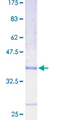 TP53TG1 Protein - 12.5% SDS-PAGE Stained with Coomassie Blue