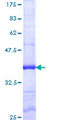 TP53TG5 Protein - 12.5% SDS-PAGE Stained with Coomassie Blue.