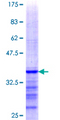 TPD52L1 Protein - 12.5% SDS-PAGE Stained with Coomassie Blue.
