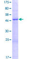 TPRG1L Protein - 12.5% SDS-PAGE of human FAM79A stained with Coomassie Blue