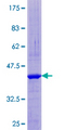 TRAPPC1 / MUM2 Protein - 12.5% SDS-PAGE of human TRAPPC1 stained with Coomassie Blue