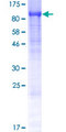 TRAPPC11 Protein - 12.5% SDS-PAGE of human C4orf41 stained with Coomassie Blue