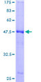 TRAPPC5 Protein - 12.5% SDS-PAGE of human TRAPPC5 stained with Coomassie Blue