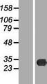 TREX2 Protein - Western validation with an anti-DDK antibody * L: Control HEK293 lysate R: Over-expression lysate