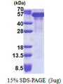 TRIM28 / KAP1 Protein