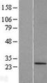 TRIM48 / RNF101 Protein - Western validation with an anti-DDK antibody * L: Control HEK293 lysate R: Over-expression lysate