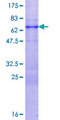 TRIM52 Protein - 12.5% SDS-PAGE of human TRIM52 stained with Coomassie Blue