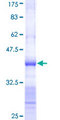 TRIM52 Protein - 12.5% SDS-PAGE Stained with Coomassie Blue.