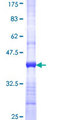 TRIM61 Protein - 12.5% SDS-PAGE Stained with Coomassie Blue.