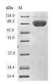 TRIM69 / Trif Protein - (Tris-Glycine gel) Discontinuous SDS-PAGE (reduced) with 5% enrichment gel and 15% separation gel.