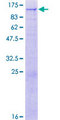 TRMT1L Protein - 12.5% SDS-PAGE of human C1orf25 stained with Coomassie Blue