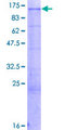 TROAP Protein - 12.5% SDS-PAGE of human TROAP stained with Coomassie Blue