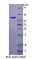 TRPA1 Protein - Recombinant  Transient Receptor Potential Cation Channel Subfamily A, Member 1 By SDS-PAGE